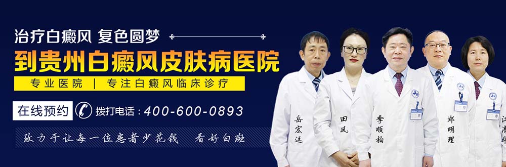 贵州白癜风医院在线咨询